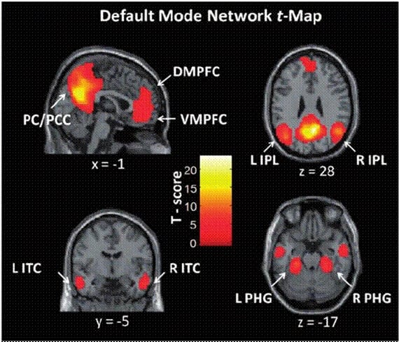 Quatro cortes de ressonância magnética do cérebro, em tons de cinza, com manchas coloridas de vermelho a amarelo marcando as regiões da rede de modo padrão (Default Mode Network), entre elas os córtices pré-frontais ventromedial (VMPFC) e dorsomedial (DMPFC).